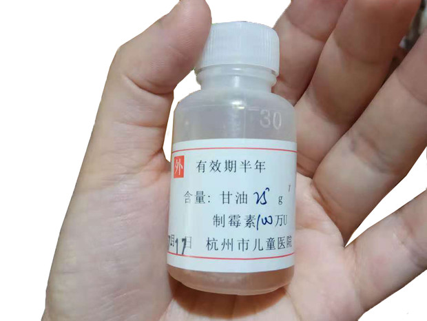 寶寶嘴里長了白色斑點，很可能是鵝口瘡